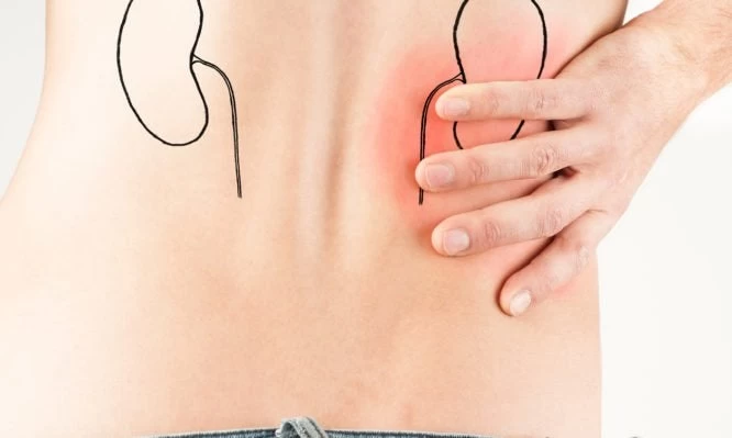 Κολικός τους νεφρού: Τα συμπτώματα και η αντιμετώπισή τους